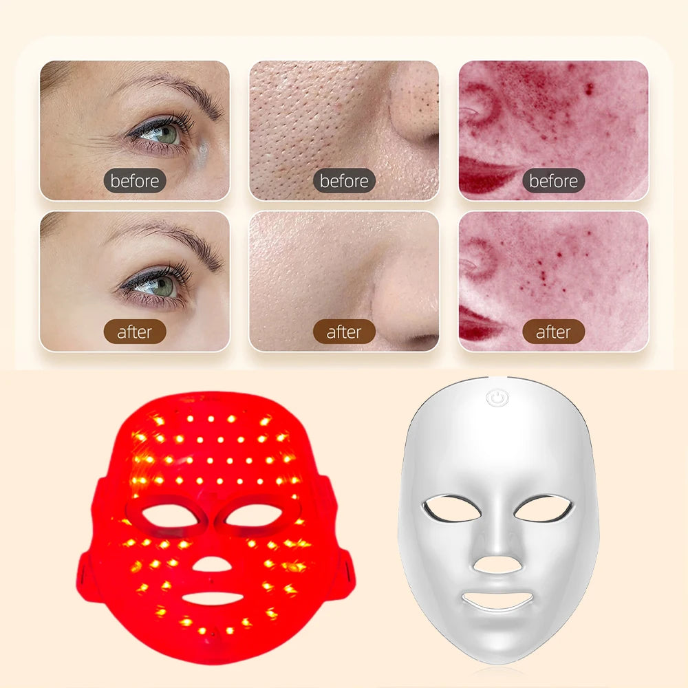 ✨ ALMA LED GLOW – Masque Visage LED 7 Couleurs